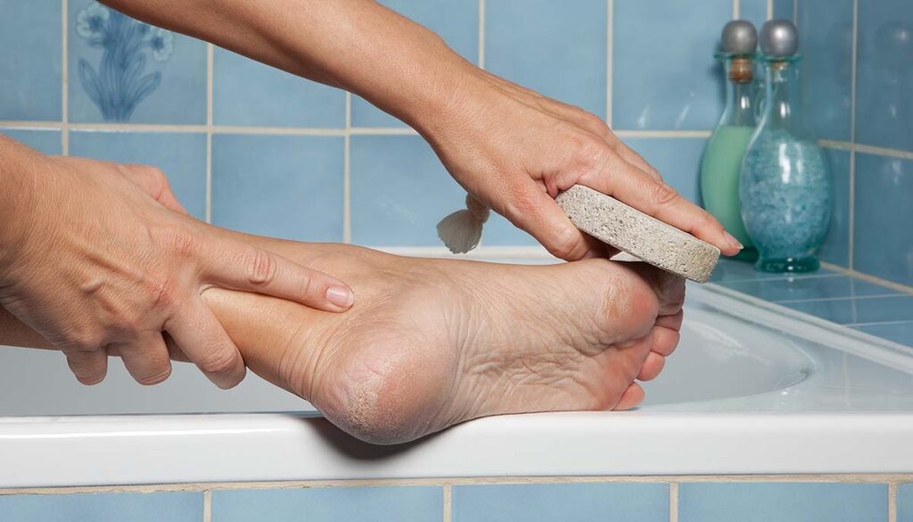 Hand removing callus from feet using pumice stone