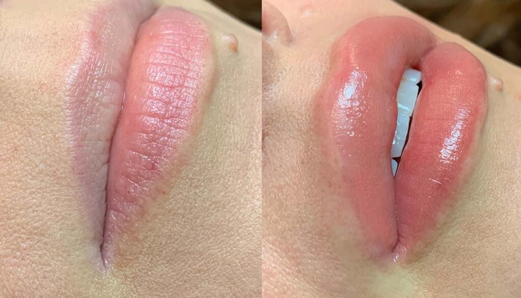 Lip blush tattoo treatment before and after